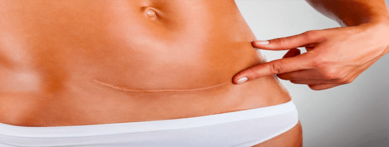 10-Ways-To-Reduce-The-Appearance-Of-Scars