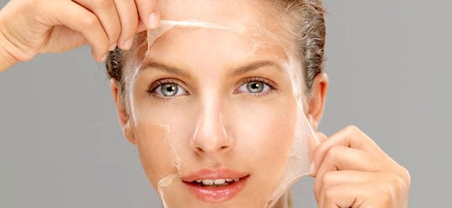 The Long List of the Best Acne Treatments: Chemical Peels