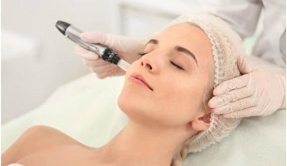 The Anti-Aging Miracle Worker: MicroNeedling