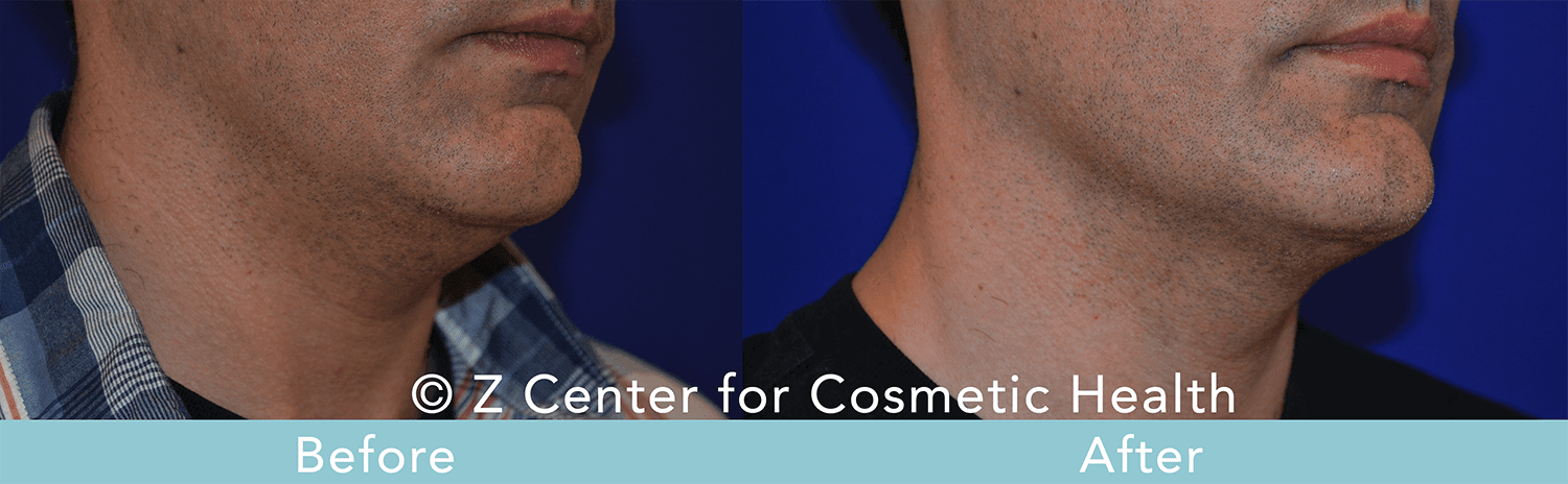 spa treatments for men