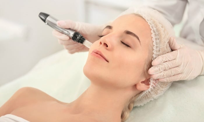 Effective Ways to Remove Acne Scars