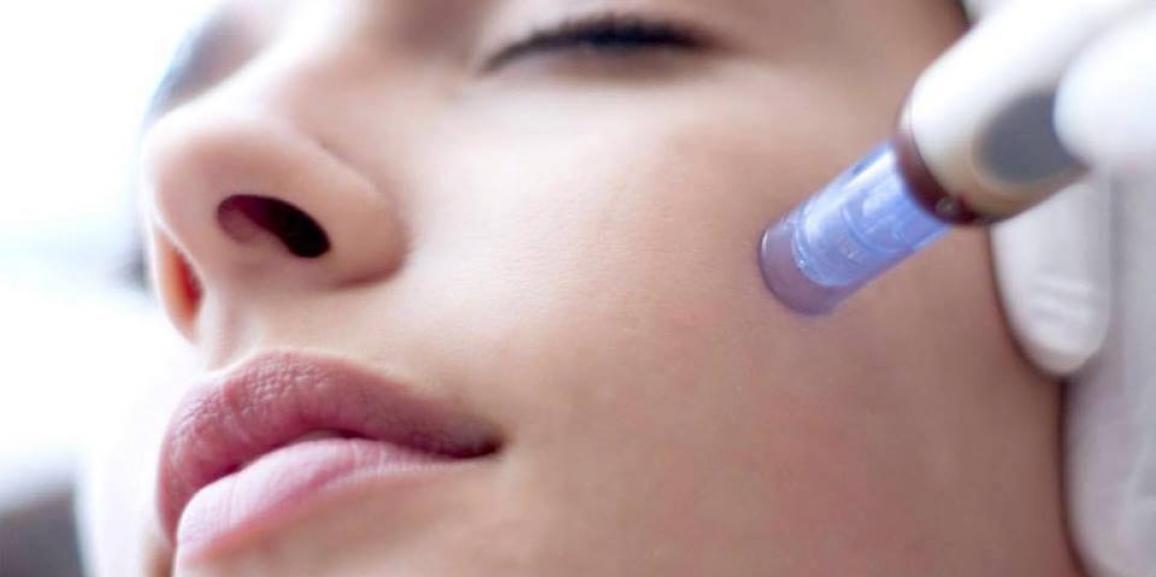 5-Surprising-Microneedling-Benefits-for-Skin