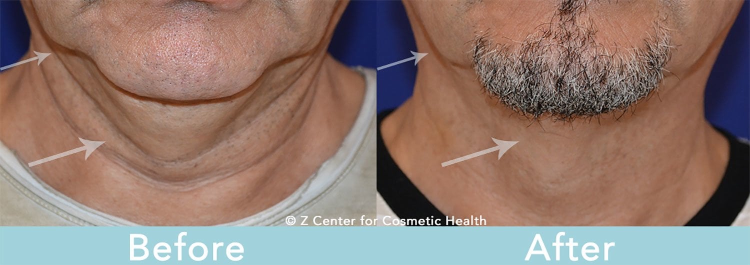 spa treatments for men
