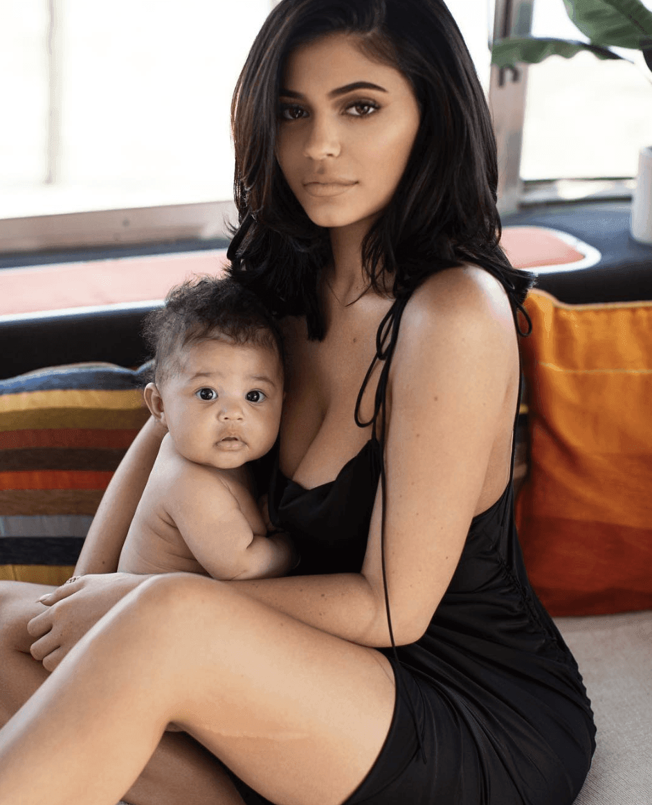 kylie jenner's lip fillers