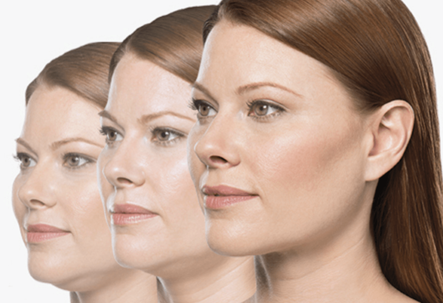double chin treatment