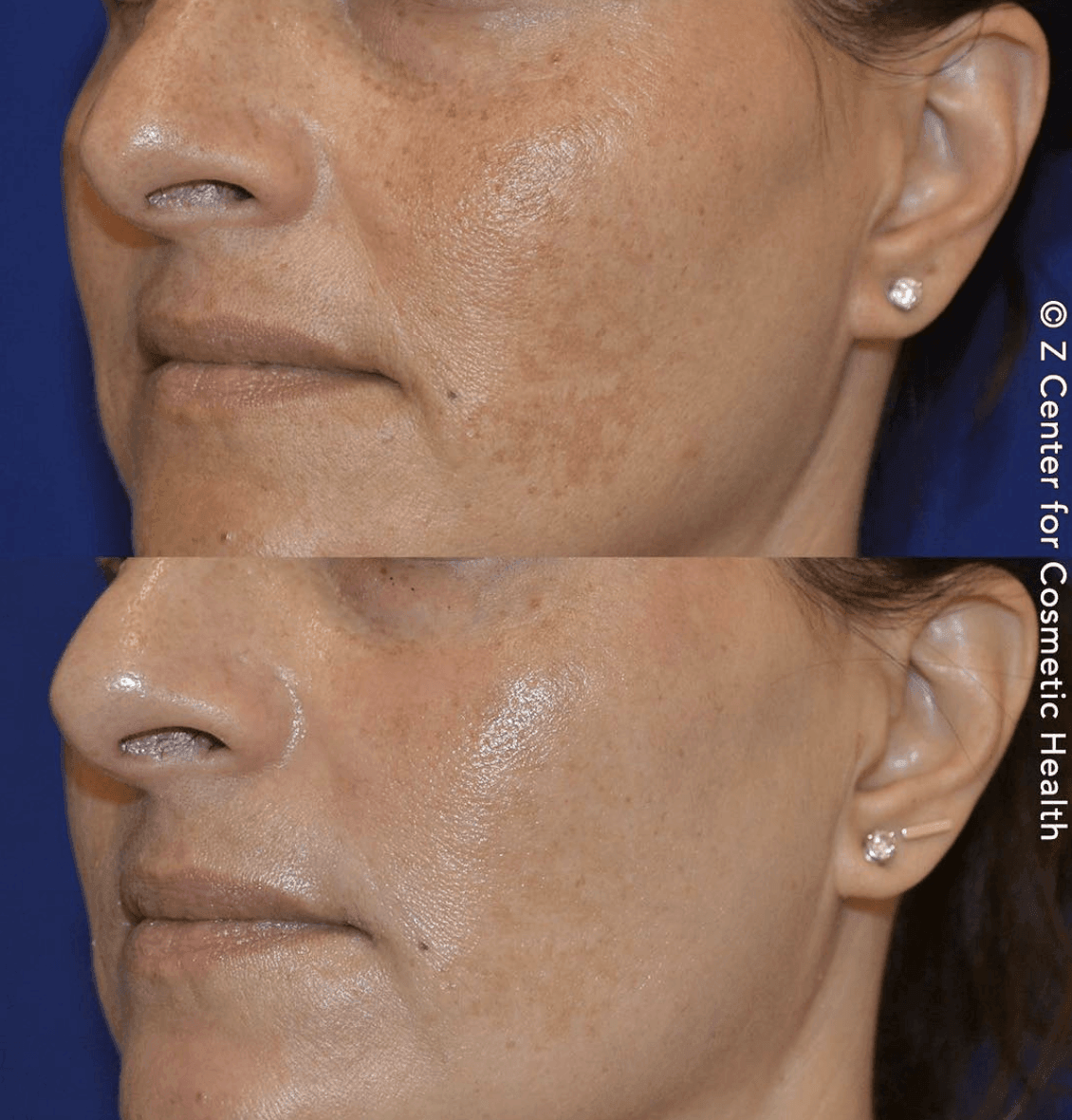healthier looking skin