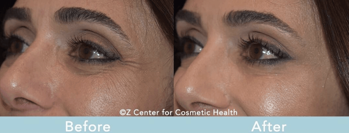 healthier looking skin
