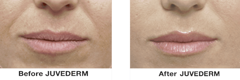 healthier looking skin