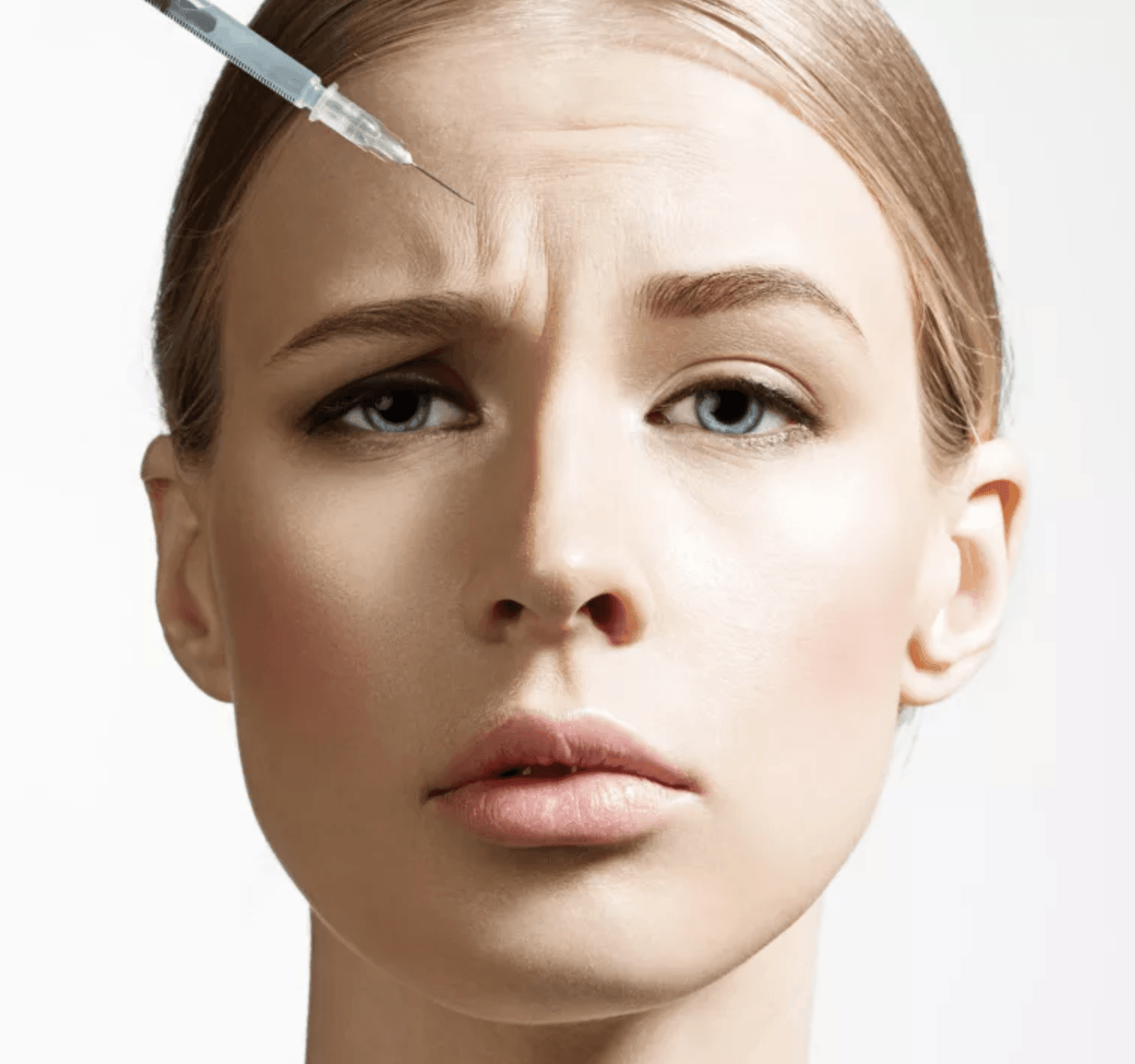 Botox-101--The-Dos-and-Don---ts