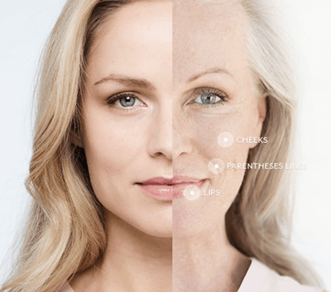 Volbella vs. Vollure: What’s the Difference?