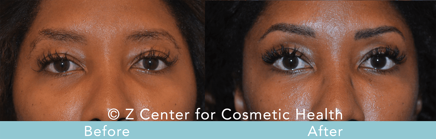 how to look less tired