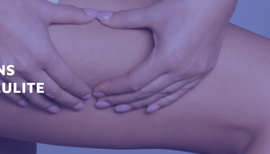Tried and Tested Solutions to Cellulite