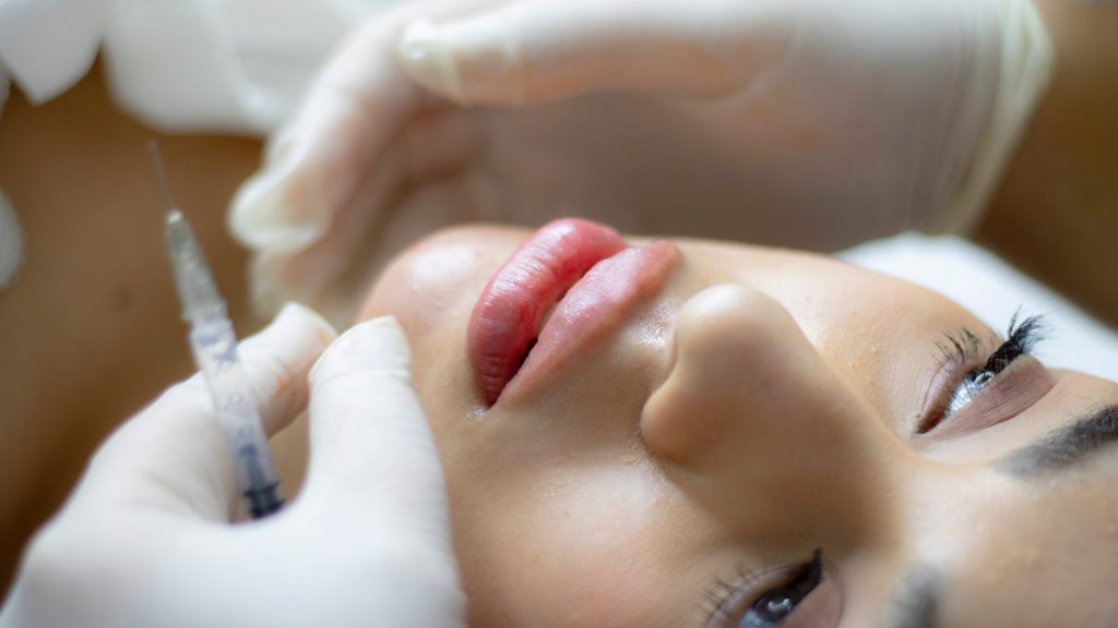 botox dermal fillers