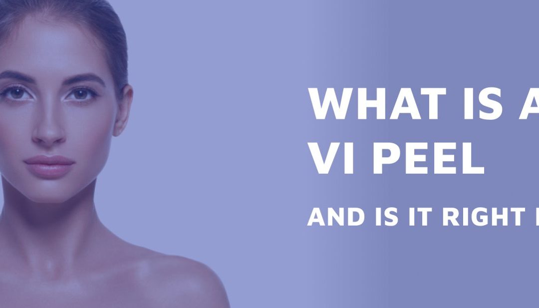 What Is A VI Peel And Is It Right For Me?