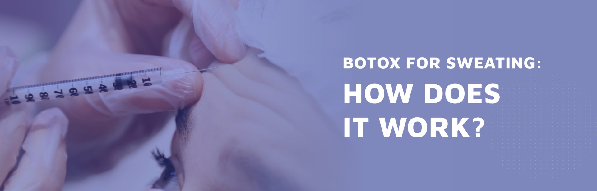 Botox-For-Sweating--How-Does-It-Work-