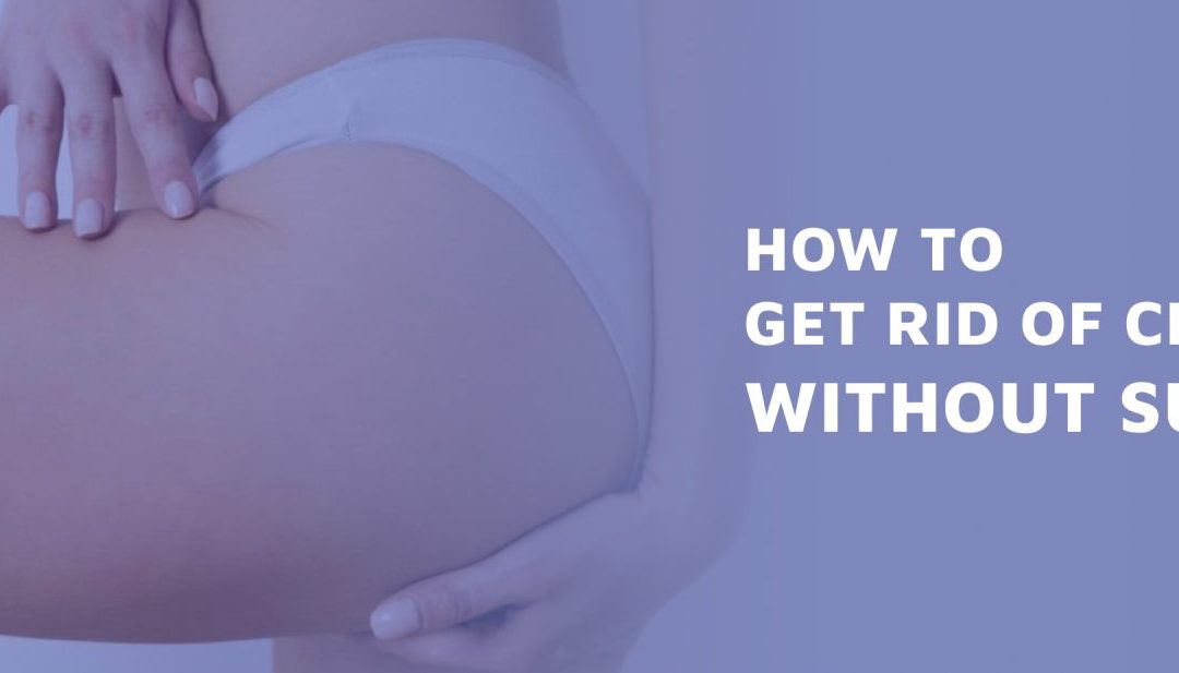 How To Get Rid Of Cellulite Without Surgery