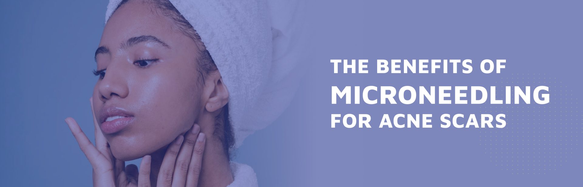 The-Benefits-of-Microneedling-For-Acne-Scars