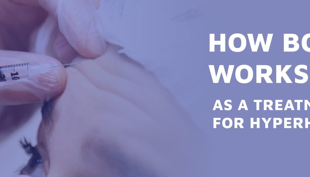 How Botox Works as a Treatment for Hyperhidrosis