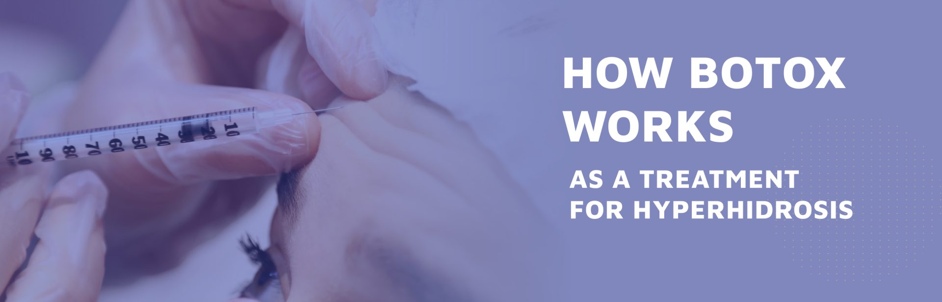How-Botox-Works-as-a-Treatment-for-Hyperhidrosis