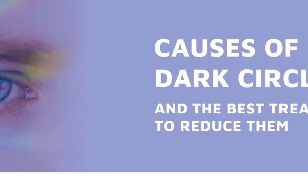 Causes of Dark Circles and the Best Treatments to Reduce Them