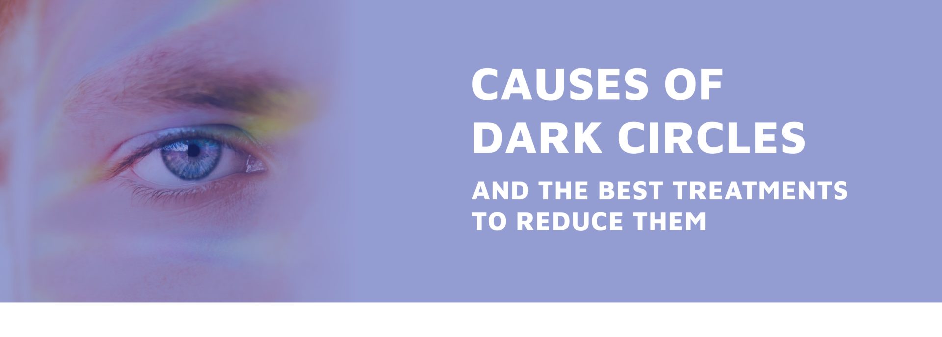 Causes-of-Dark-Circles-and-the-Best-Treatments-to-Reduce-Them