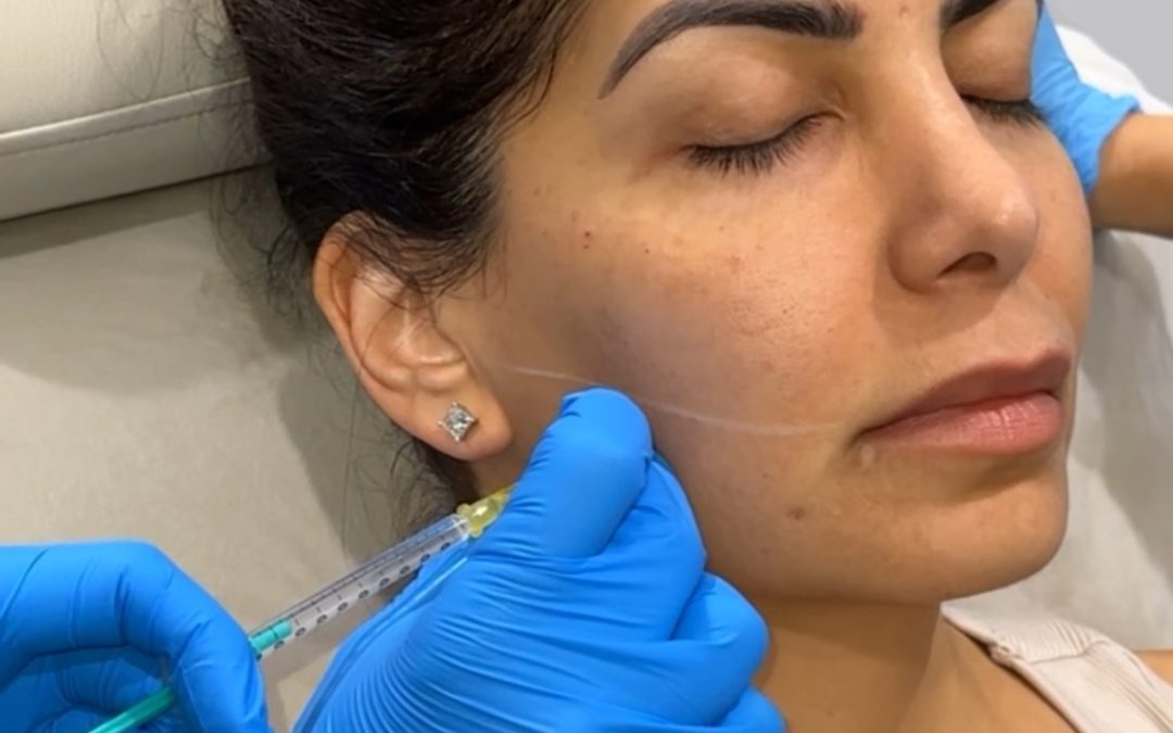Masseter Botox: Benefits, Risks, and What to Expect