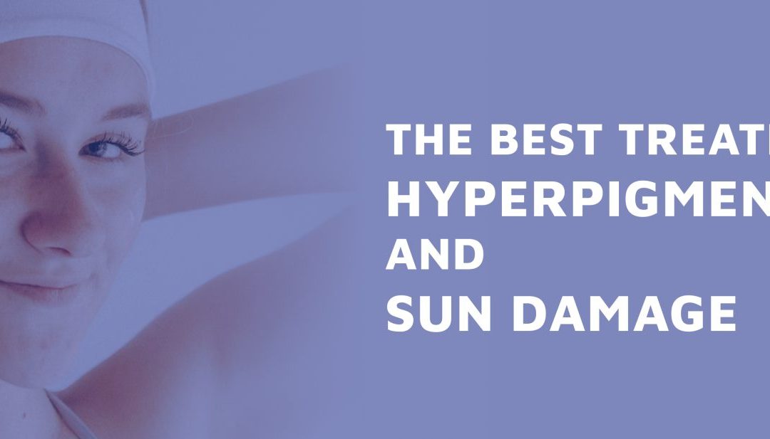 The Best Treatments For Hyperpigmentation And Sun Damage